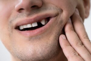 Tooth Loss Solutions